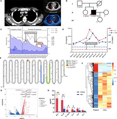 Case Report: Missing zinc finger domains: hemophagocytic lymphohistiocytosis in a GATA2 deficiency patient triggered by non-tuberculous mycobacteriosis